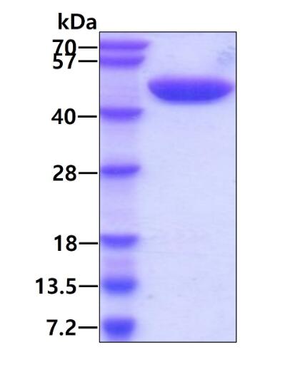 3 μg by SDS-PAGE under reducing condition and visualized by coomassie blue stain.